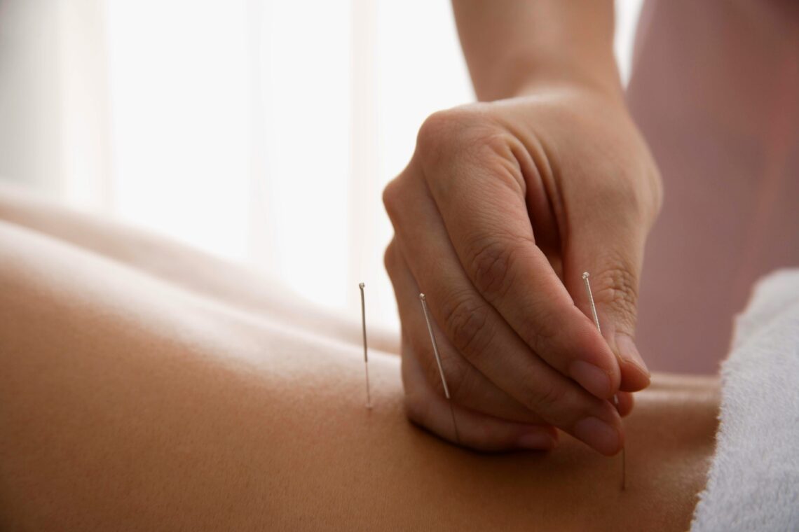 Acupuncturists at work